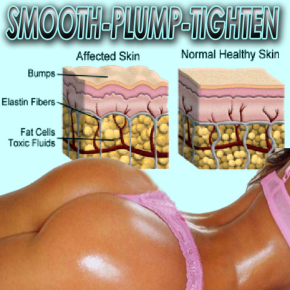 Buttock Enhancing Crepe Erasing erase Crepe skin toner cream - Picture 3 of 4